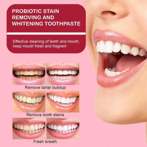 Whitening Toothpaste